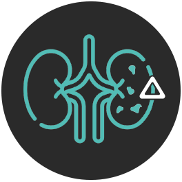 willian-mosquin-simoes-litotripsia